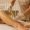 EPILATION